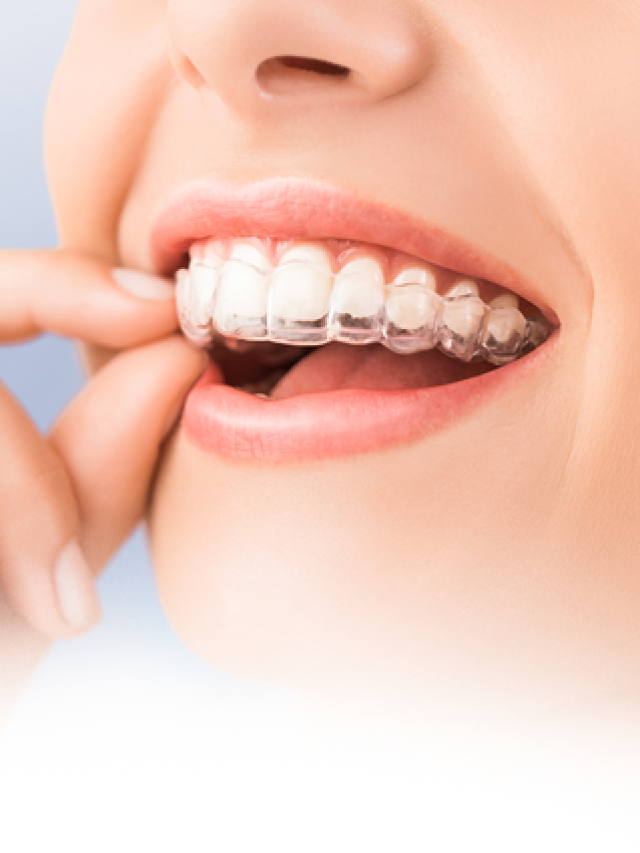 What makes Invisalign treatment stand out?